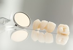 Dental crown and fixed bridge restoration before placement