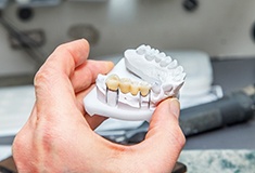 Dental bridge in Forest on clay model