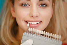 Woman's smile compared with tooth color chart