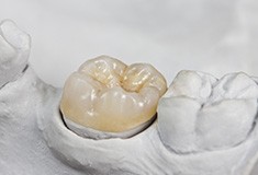 Model smile with dental crown restoration