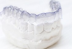 Clear aligner on dental mold.