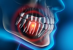 a computer illustration showing a toothache