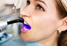 A dentist performing a filling treatment on a woman