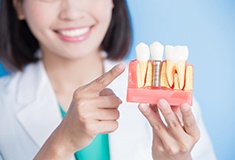 A dentist pointing to a dental implant model