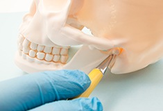 A TMJ disorder is a painful condition affecting the temporomandibular joint