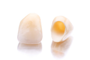 Two beautiful, intact, and loose dental crown on white background