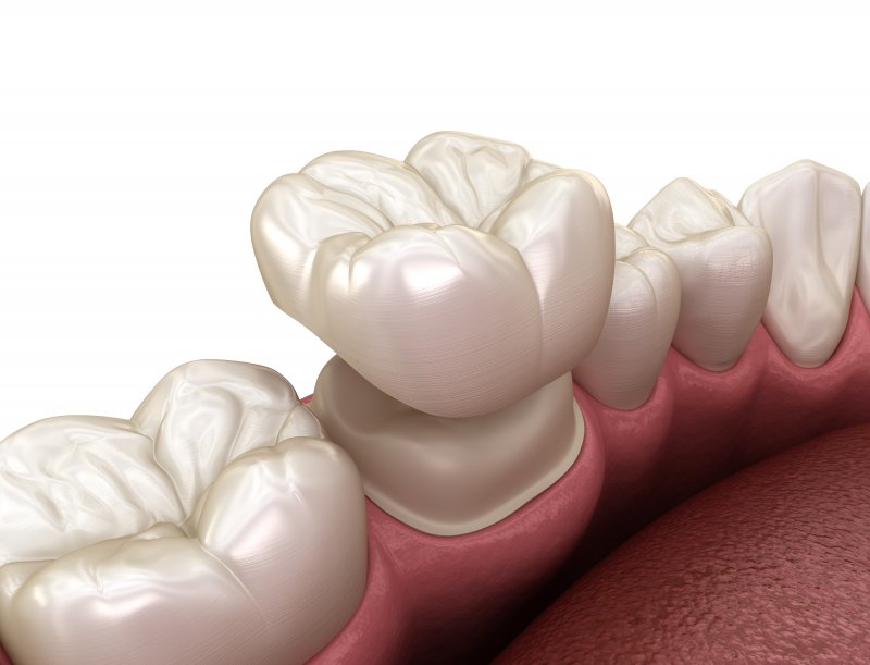 illustration of a dental crown in Forest