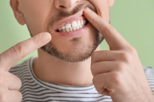 a patient pointing to his gums 