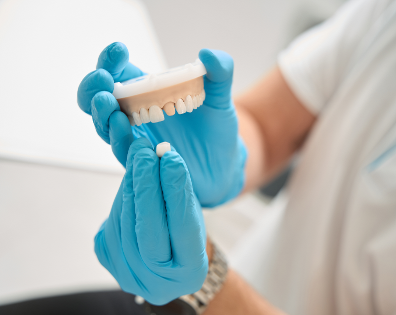 Model dental crown