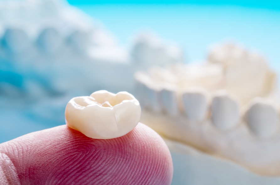 Dental crown on a finger tip